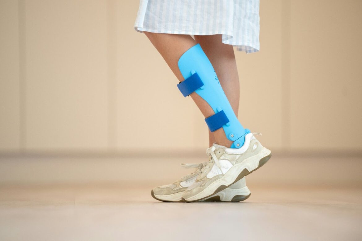 4 Signs You Need Ankle Replacement Surgery