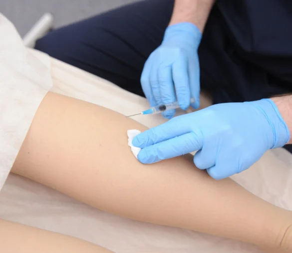 What To Expect During Your Sclerotherapy Treatment Session